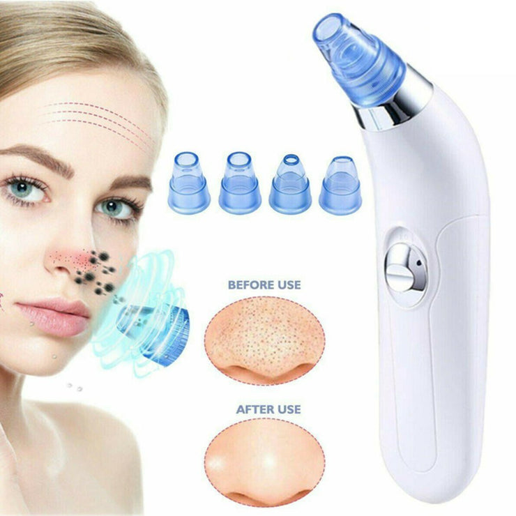 Blackhead Electric Pore Export Blackhead Cleaner